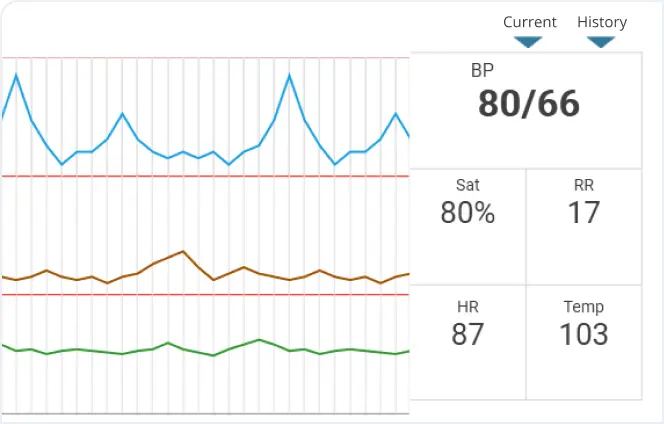 Patient Monitor